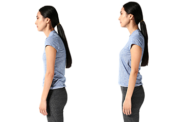 Postural Reconditioning